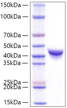 Recombinant Human DPEP1 Protein