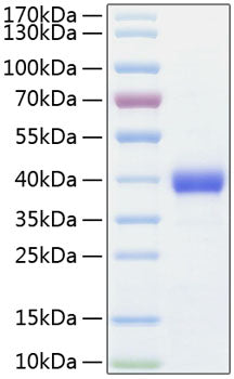 Recombinant Human TEM8/ANTXR1 Protein