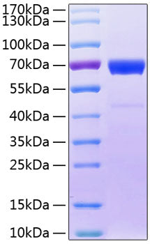 Recombinant Human IL-20RB Protein