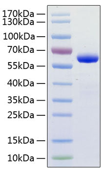 Recombinant Human TNFSF13/APRIL/CD256 Protein