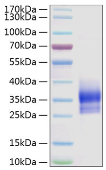 Recombinant Human Sclerostin/SOST Protein