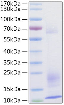 Recombinant Human TSLP Protein