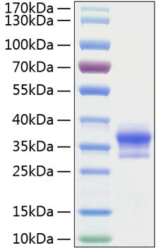 Recombinant Human LOX-1/OLR1 Protein