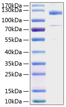 Recombinant Human Thrombospondin-1/THBS1 Protein