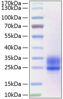 Recombinant Human Frizzled-5/FZD5 Protein