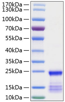 Recombinant Human GTPase KRas/KRAS Protein