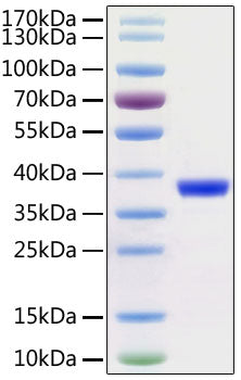 Recombinant SARS-CoV-2 3C-like Proteinase Protein