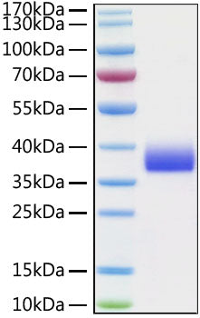 Recombinant Cynomolgus Siglec-15/CD33L3 Protein