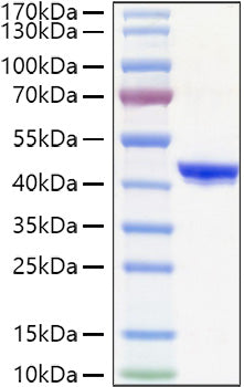 Recombinant Human YKL-40/CHI3L1 Protein