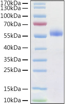 Recombinant Human Frizzled-4/FZD4/CD344 Protein