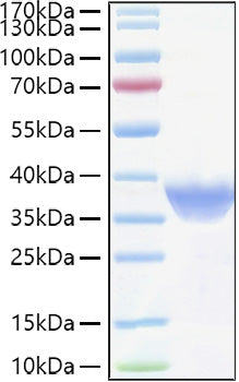 Recombinant Human FR-alpha/FOLR1 Protein