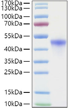 Recombinant Human VSIG4 Protein