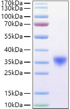 Recombinant Mouse Fc-gamma RIV/CD16-2 Protein