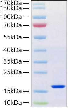 Recombinant Human REG-4 Protein