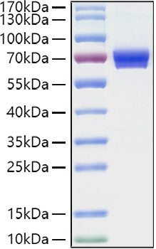 Recombinant Human IL-2-RA/CD25 Protein