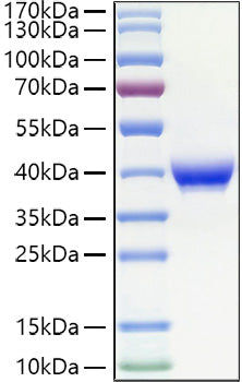 Recombinant Human Fc epsilon RII/CD23 Protein