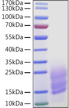 Recombinant Human Fibronectin/CIG/FN1 Protein