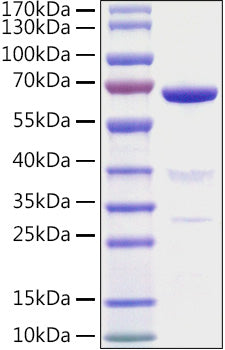 Recombinant Mouse 5'-Nucleotidase/CD73 Protein