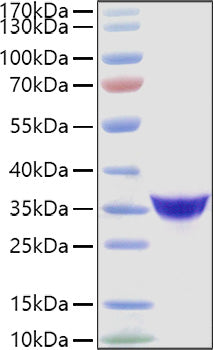 Recombinant Human Adiponectin/Acrp30/ADIPOQ Protein