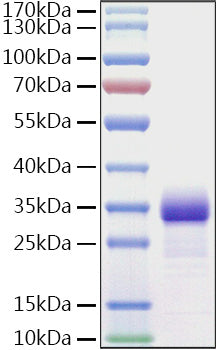 Recombinant Mouse Adiponectin/Acrp30/ADIPOQ Protein