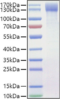 Recombinant Mouse OSMR/IL-31RB Protein