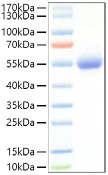 Recombinant Mouse IL-5RA/CD125 Protein