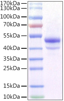 Recombinant Mouse Carbonic Anhydrase IX/CA9 Protein