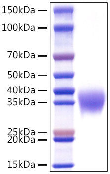 Recombinant Human Apolipoprotein H/ApoH Protein