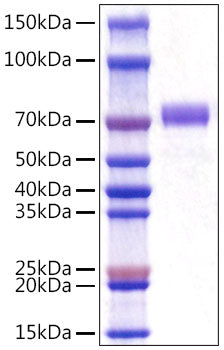 Recombinant Mouse CD5 Protein