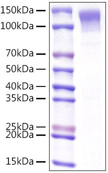 Recombinant Mouse Low-density lipoprotein receptor/LDLR Protein