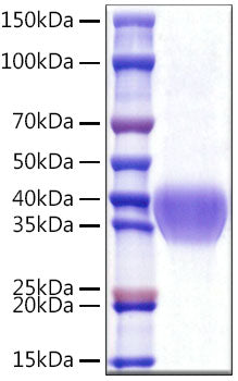 Recombinant Human GOLPH2/GOLM1 Protein