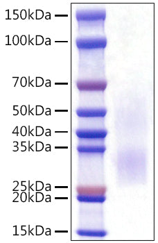 Recombinant Rat PD-1/PDCD1/CD279 Protein