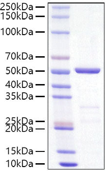 Recombinant SARS-CoV-2 Nucleocapsid (B.1.617.2/Delta) Protein