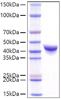 Recombinant Mouse YKL-40/CHI3L1 Protein