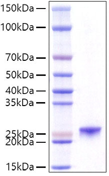 Recombinant Mouse Prolactin/PRL Protein