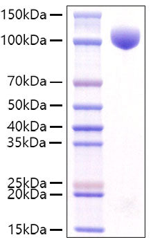 Recombinant Mouse c-kit/CD117 Protein