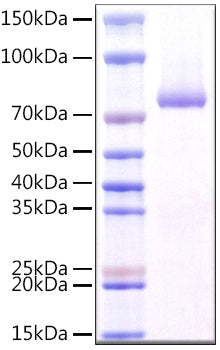 Recombinant Human CLEC7A/Dectin-1/CD369 Protein