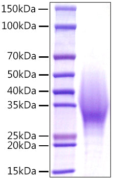 Recombinant Mouse IL-18BP Protein