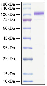 Recombinant Human Lysyl hydroxylase 2/PLOD2 Protein