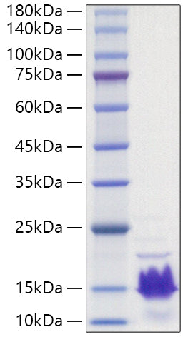 Recombinant Human Parathormone/PTH Protein