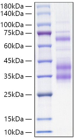 Recombinant Mouse Clusterin/Apo-J/CLU Protein