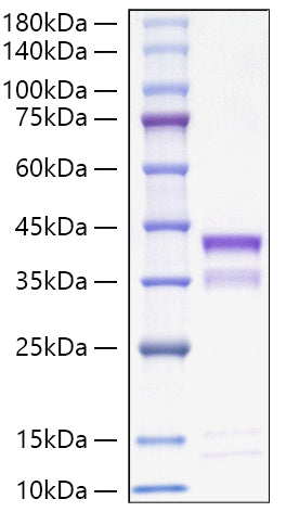 Recombinant Mouse Cathepsin S/CTSS Protein