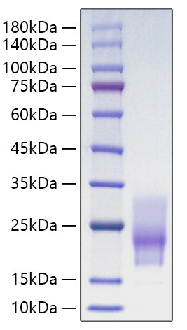 Recombinant Human CD63 Protein