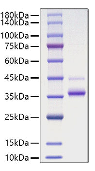 Recombinant Human CCL19/MIP-3 beta Protein