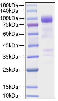 Recombinant Mouse IL1RL1 Protein