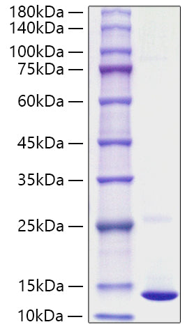 Recombinant Human S100A10 Protein