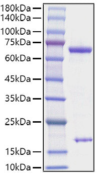 Recombinant Rat PCSK9 Protein