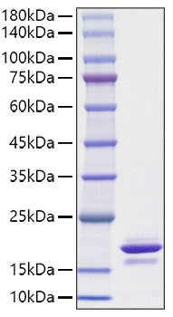 Recombinant Human Alpha-synuclein/SNCA Protein