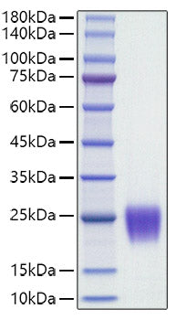 Recombinant Human Follicle Stimulating Hormone (FSH) (CGA&FSHB) Protein