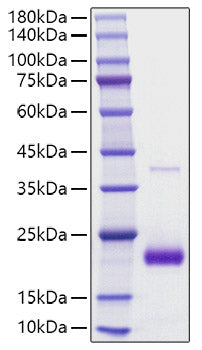 Recombinant human SECTM1 Protein